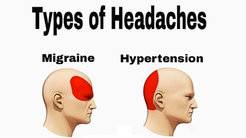 types of headaches know your meme tyes types of headaches know your meme
