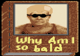 Why I Am So Bald?