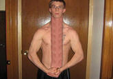 Dick Neck