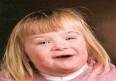 Retard Girl