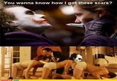 The Human Centipede