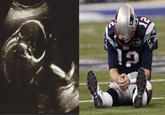Bradying