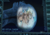 This is someone dying while having an MRI scan.