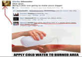 Apply Cold Water To That Burn