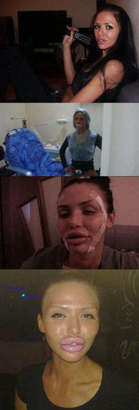 Duck Face
