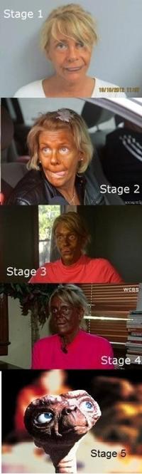Patricia Krentcil (Tanning Mom)