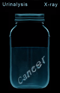 Cancer