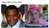 Sammy Sosa's Bleached Skin | Know Your Meme d0f - Sammy Sosa's Bleached Skin | Know Your Meme