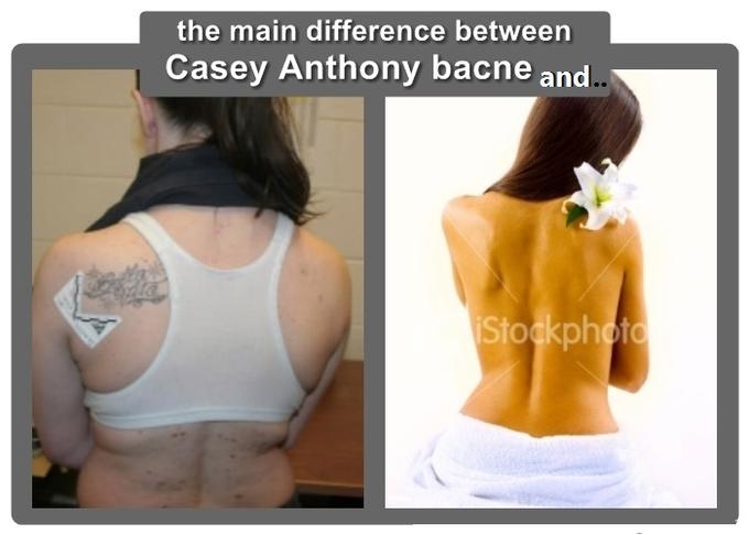 CASEY ANTHONY IS NOT AS HOT AS SHE USED TO BE BEFOR SHE KILLED A BABY.